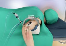 Elbow Arthroscopy